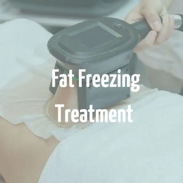 fat freezing treatment Falkirk