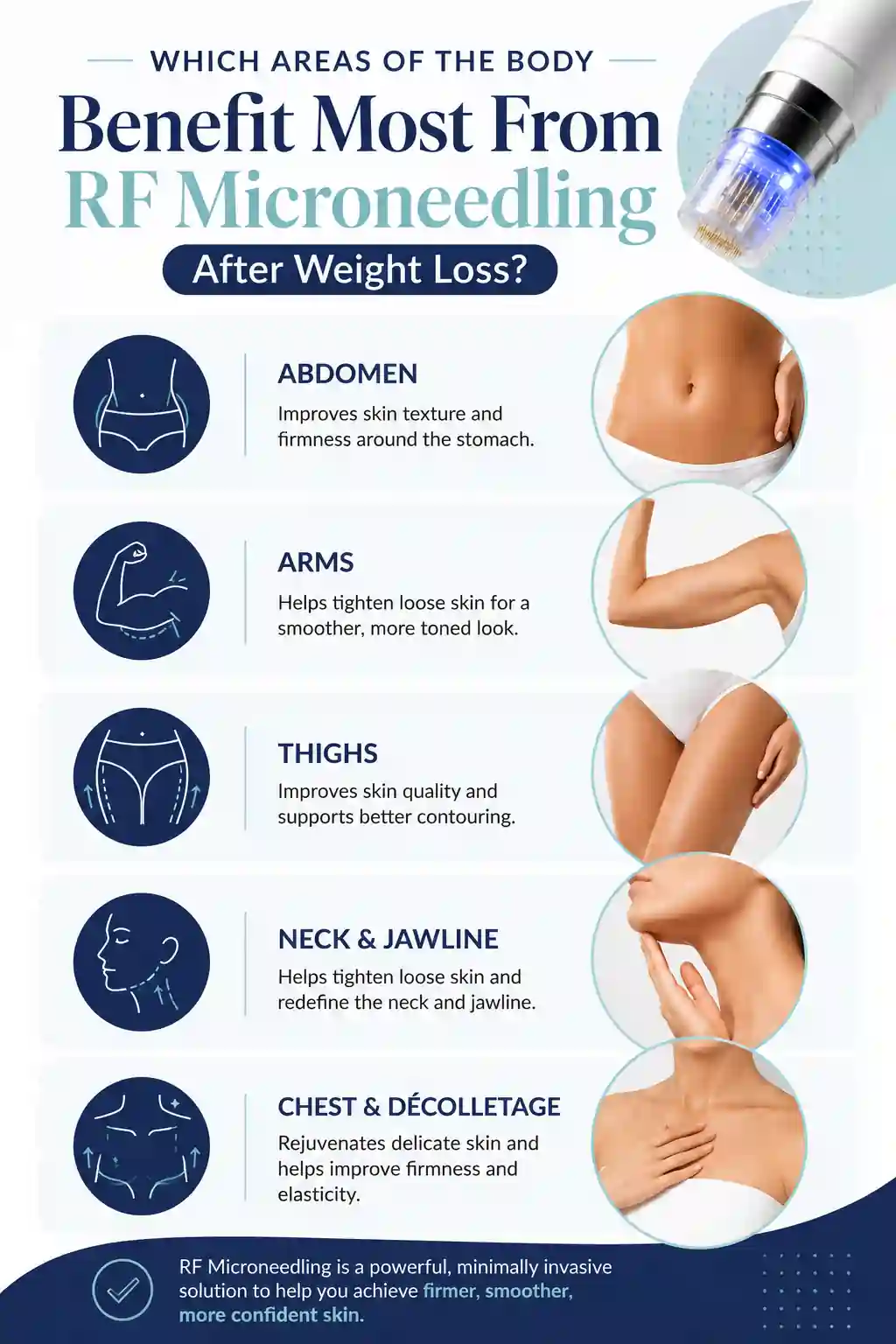 Which Areas of the Body Benefit Most From RF Microneedling After Weight Loss Falkirk